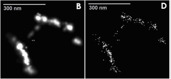 Tabakmosaikvirus (Super-Resolution Mikroskop-Aufnahme)