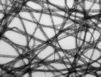 Hellfeldmikroskopie, Kontrast wird durch Absorption des Lichts im Objekt erzeugt.